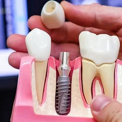 Turismo dentale