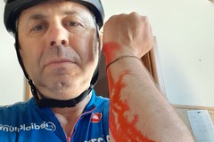 L'ex sindaco Depalma investito in bici: «È scappato come un vigliacco»