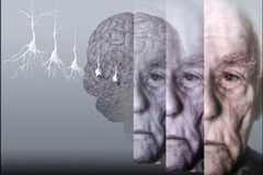 Alzheimer, l'Anthropos organizza un seminario