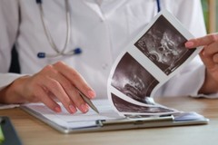 Partita la campagna regionale di prevenzione del tumore all'utero