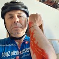 L'ex sindaco Depalma investito in bici: «È scappato come un vigliacco»
