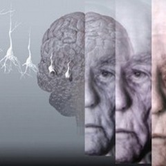 Il 28 settembre tavola rotonda sull'Alzheimer