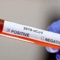 Coronavirus, 786 positivi e 31 decessi in Puglia