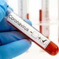 Coronavirus, in Puglia 1.803 positivi e 110 morti