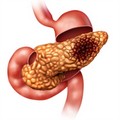 Cancro del pancreas: cosa aspettarsi dalle terapie avanzate?