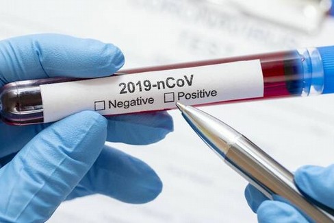 test coronavirus x